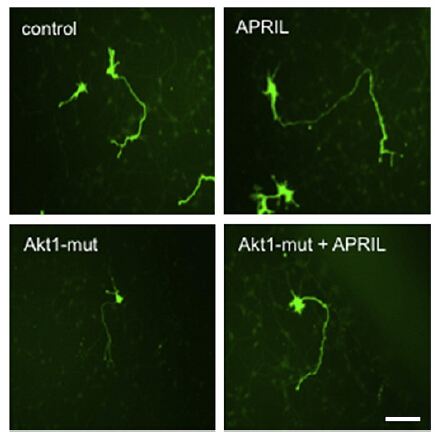 Figure from citation: Immunofluorescence of tGFP-fused protein level by using anti-tGFP antibody in mouse E18 hippocampal pyramidal neurons. Dilution: 1:250 <a href="http://www.ncbi.nlm.nih.gov/pubmed/24444792" target="_blank">View Citation</a>