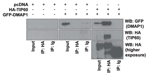 Figure from citation: Western Blot of tGFP-fused protein level by using anti-tGFP antibody in 293A cells. Dilution: 1:1000 <a href="http://www.ncbi.nlm.nih.gov/pubmed/23318425" target="_blank">View Citation</a>