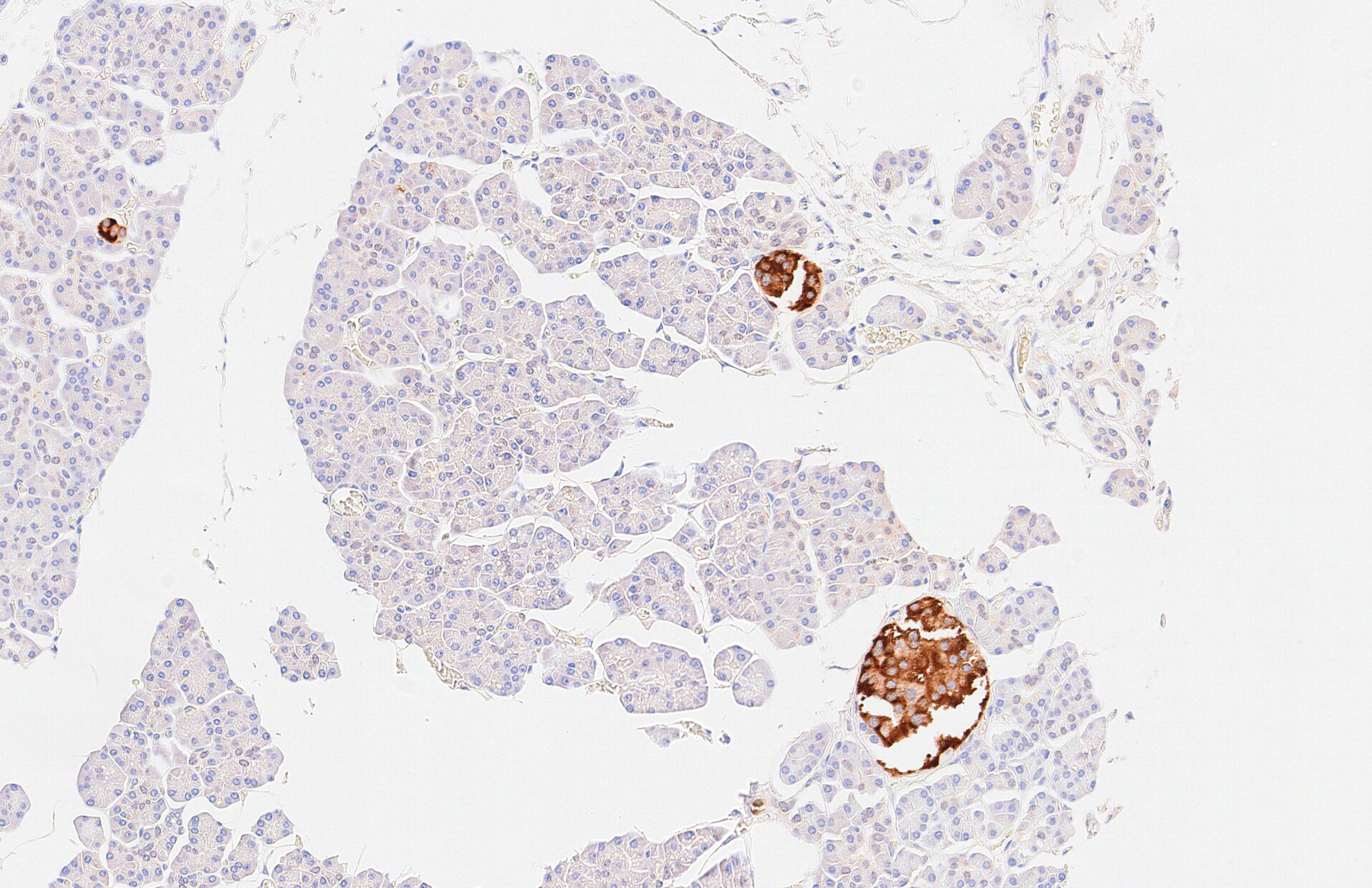 Immunohistochemical staining of paraffin-embedded human pancreas using anti-PDX1 mouse monoclonal antibody.(Heat-induced epitope retrieval by 1mM EDTA in 10mM Tris buffer (pH8.0) at 120°C for 3 min, TA500038)