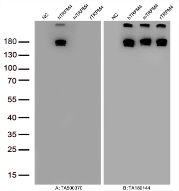 Figure A, Western blot analysis of overexpressed lysates (5ug per lane) from HEK293T cells transfected with empty plasmid (<a href = "https://www.origene.com/catalog/vectors/mammalian-expression-vectors/ps100001-pcmv6-entry-mammalian-expression-vector" title="PS100001" class="">PS100001</a>, NC), human TRPM4  plasmid (<a href = "https://www.origene.com/catalog/cdna-clones/expression-plasmids/rc216888-trpm4-nm-017636-human-tagged-orf-clone" title="RC216888" class="">RC216888</a>, hTRPM4), mouse TRPM4 plasmid (<a href = "https://www.origene.com/catalog/cdna-clones/expression-plasmids/mr211808-trpm4-nm-175130-mouse-tagged-orf-clone" title="MR211808" class="">MR211808</a>, mTRPM4), rat TRPM4 plasmid (<a href = "https://www.origene.com/catalog/cdna-clones/expression-plasmids/rr214731-trpm4-nm-001136229-rat-tagged-orf-clone" title="RR214731" class="">RR214731</a>, rTRPM4) using anti-TRPM4 antibody TA500370 (1:20000@1mg/ml). Figure B, Western blot analysis of  the same samples as figure A with anti-DDK antibody (<a href = "https://www.origene.com/catalog/antibodies/tag-antibodies/ta180144-ddk-flag-mouse-monoclonal-antibody-clone-oti11c3" title="TA180144" class="">TA180144</a>, 1:10000@1mg/ml)