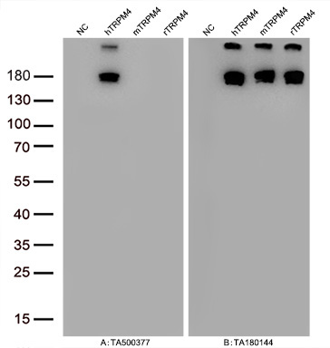 Figure A, Western blot analysis of overexpressed lysates (5ug per lane) from HEK293T cells transfected with empty plasmid (<a href = "https://www.origene.com/catalog/vectors/mammalian-expression-vectors/ps100001-pcmv6-entry-mammalian-expression-vector" title="PS100001" class="">PS100001</a>, NC), human TRPM4  plasmid (<a href = "https://www.origene.com/catalog/cdna-clones/expression-plasmids/rc216888-trpm4-nm-017636-human-tagged-orf-clone" title="RC216888" class="">RC216888</a>, hTRPM4), mouse TRPM4 plasmid (<a href = "https://www.origene.com/catalog/cdna-clones/expression-plasmids/mr211808-trpm4-nm-175130-mouse-tagged-orf-clone" title="MR211808" class="">MR211808</a>, mTRPM4), rat TRPM4 plasmid (<a href = "https://www.origene.com/catalog/cdna-clones/expression-plasmids/rr214731-trpm4-nm-001136229-rat-tagged-orf-clone" title="RR214731" class="">RR214731</a>, rTRPM4) using anti-TRPM4 antibody TA500377 (1:20000@1mg/ml). Figure B, Western blot analysis of  the same samples as figure A with anti-DDK antibody (<a href = "https://www.origene.com/catalog/antibodies/tag-antibodies/ta180144-ddk-flag-mouse-monoclonal-antibody-clone-oti11c3" title="TA180144" class="">TA180144</a>, 1:10000@1mg/ml).
