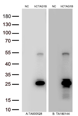Figure A, Western blot analysis of overexpressed lysates (5ug per lane) from HEK293T cells transfected with empty plasmid (<a href = "https://www.origene.com/catalog/vectors/mammalian-expression-vectors/ps100001-pcmv6-entry-mammalian-expression-vector" title="PS100001" class="">PS100001</a>, NC), human CTAG1B  plasmid (<a href = "https://www.origene.com/catalog/cdna-clones/expression-plasmids/rc213318-ny-eso-1-ctag1b-nm-001327-human-tagged-orf-clone" title="RC213318" class="">RC213318</a>, hCTAG1B) using anti-CTAG1B antibody TA500528 (1:20000@1mg/ml). Figure B, Western blot analysis of  the same samples as figure A with anti-DDK antibody (<a href = "https://www.origene.com/catalog/antibodies/tag-antibodies/ta180144-ddk-flag-mouse-monoclonal-antibody-clone-oti11c3" title="TA180144" class="">TA180144</a>, 1:20000@1mg/ml)