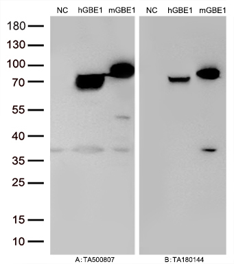 Figure A, Western blot analysis of overexpressed lysates (25ug per lane) from HEK293T cells transfected with empty plasmid (<a href = "https://www.origene.com/catalog/vectors/mammalian-expression-vectors/ps100001-pcmv6-entry-mammalian-expression-vector" title="PS100001" class="">PS100001</a>, NC), human GBE1  plasmid (<a href = "https://www.origene.com/catalog/cdna-clones/expression-plasmids/rc204152-gbe1-nm-000158-human-tagged-orf-clone" title="RC204152" class="">RC204152</a>, hGBE1), mouse GBE1 plasmid (<a href = "https://www.origene.com/catalog/cdna-clones/expression-plasmids/mr210139-gbe1-nm-028803-mouse-tagged-orf-clone" title="MR210139" class="">MR210139</a>, mGBE1) using anti-GBE1 antibody <a href = "https://www.origene.com/catalog/antibodies/primary-antibodies/ta500807-gbe1-mouse-monoclonal-antibody-clone-id-oti4d9" title="TA500807" class="">TA500807</a> (1:20000@1mg/ml). Figure B, Western blot analysis of  the same samples as figure A with anti-DDK antibody (<a href = "https://www.origene.com/catalog/antibodies/tag-antibodies/ta180144-ddk-flag-mouse-monoclonal-antibody-clone-oti11c3" title="TA180144" class="">TA180144</a>, 1:10000@1mg/ml)