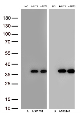 Figure A, Western blot analysis of overexpressed lysates (15ug per lane) from HEK293T cells transfected with empty plasmid (<a href = "https://www.origene.com/catalog/vectors/mammalian-expression-vectors/ps100001-pcmv6-entry-mammalian-expression-vector" title="PS100001" class="">PS100001</a>, NC), human RIT2  plasmid (<a href = "https://www.origene.com/catalog/cdna-clones/expression-plasmids/rc205367-rit2-nm-002930-human-tagged-orf-clone" title="RC205367" class="">RC205367</a>, hRIT2), mouse RIT2 plasmid (<a href = "https://www.origene.com/catalog/cdna-clones/expression-plasmids/mr202437-rit2-nm-009065-mouse-tagged-orf-clone" title="MR202437" class="">MR202437</a>, mRIT2) using anti-RIT2 antibody <a href = "https://www.origene.com/catalog/antibodies/primary-antibodies/ta501701-rit2-mouse-monoclonal-antibody-clone-id-oti4a6" title="TA501701" class="">TA501701</a> (1:10000@1mg/ml). Figure B, Western blot analysis of  the same samples as figure A with anti-DDK antibody (<a href = "https://www.origene.com/catalog/antibodies/tag-antibodies/ta180144-ddk-flag-mouse-monoclonal-antibody-clone-oti11c3" title="TA180144" class="">TA180144</a>, 1:10000@1mg/ml)