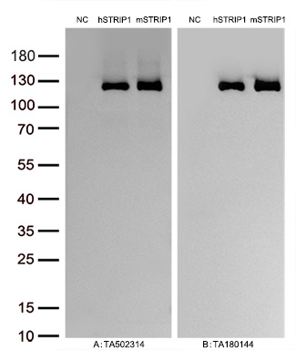Figure A, Western blot analysis of overexpressed lysates (5ug per lane) from HEK293T cells transfected with empty plasmid (<a href = "https://www.origene.com/catalog/vectors/mammalian-expression-vectors/ps100001-pcmv6-entry-mammalian-expression-vector" title="PS100001" class="">PS100001</a>, NC), human STRIP1  plasmid (<a href = "https://www.origene.com/catalog/cdna-clones/expression-plasmids/rc210537-fam40a-strip1-nm-033088-human-tagged-orf-clone" title="RC210537" class="">RC210537</a>, hSTRIP1), mouse STRIP1 plasmid (<a href = "https://www.origene.com/catalog/cdna-clones/expression-plasmids/mr210201-strip1-nm-153563-mouse-tagged-orf-clone" title="MR210201" class="">MR210201</a>, mSTRIP1) using anti-STRIP1 antibody TA502314 (1:10000@1mg/ml ). Figure B, Western blot analysis of  the same samples as figure A with anti-DDK antibody (<a href = "https://www.origene.com/catalog/antibodies/tag-antibodies/ta180144-ddk-flag-mouse-monoclonal-antibody-clone-oti11c3" title="TA180144" class="">TA180144</a>, 1:10000@1mg/ml)