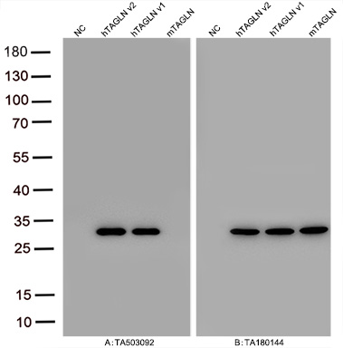 Figure A, Western blot analysis of overexpressed lysates (5ug per lane) from HEK293T cells transfected with empty plasmid (PS100001, NC), human TAGLN  plasmid (RC215789, hTAGLN v2), human TAGLN plasmid(RC202448, hTAGLN v1), mouse TAGLN plasmid (MR202069, mTAGLN) using anti-TAGLN antibody TA503092 (1:10000@1mg/ml). Figure B, Western blot analysis of  the same samples as figure A with anti-DDK antibody (TA180144, 1:10000@1mg/ml)