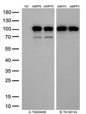 Figure A, Western blot analysis of overexpressed lysates (15ug per lane) from HEK293T cells transfected with empty plasmid (<a href = "https://www.origene.com/catalog/vectors/mammalian-expression-vectors/ps100001-pcmv6-entry-mammalian-expression-vector" title="PS100001" class="">PS100001</a>, NC), human MPP5 plasmid (<a href = "https://www.origene.com/catalog/cdna-clones/expression-plasmids/rc224752-mpp5-nm-022474-human-tagged-orf-clone" title="RC224752" class="">RC224752</a>, hMPP5), mouse MPP5 plasmid (<a href = "https://www.origene.com/catalog/cdna-clones/expression-plasmids/mr222682-mpp5-nm-019579-mouse-tagged-orf-clone" title="MR222682" class="">MR222682</a>, mMPP5) using anti-MPP5 antibody <a href = "https://www.origene.com/catalog/antibodies/primary-antibodies/ta504458-pals1-mouse-monoclonal-antibody-clone-id-oti5d10" title="TA504458" class="">TA504458</a> (1:10000@1mg/ml). Figure B, Western blot analysis of the same human MPP5 and mouse MPP5 samples as figure A with anti-DDK antibody (<a href = "https://www.origene.com/catalog/antibodies/tag-antibodies/ta180144-ddk-flag-mouse-monoclonal-antibody-clone-oti11c3" title="TA180144" class="">TA180144</a>, 1:10000@1mg/ml)