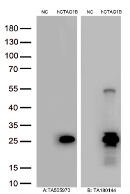 Figure A, Western blot analysis of overexpressed lysates (5ug per lane) from HEK293T cells transfected with empty plasmid (<a href = "https://www.origene.com/catalog/vectors/mammalian-expression-vectors/ps100001-pcmv6-entry-mammalian-expression-vector" title="PS100001" class="">PS100001</a>, NC), human CTAG1B  plasmid (<a href = "https://www.origene.com/catalog/cdna-clones/expression-plasmids/rc213318-ny-eso-1-ctag1b-nm-001327-human-tagged-orf-clone" title="RC213318" class="">RC213318</a>, hCTAG1B) using anti-CTAG1B antibody TA505970 (1:20000@1mg/ml). Figure B, Western blot analysis of  the same samples as figure A with anti-DDK antibody (<a href = "https://www.origene.com/catalog/antibodies/tag-antibodies/ta180144-ddk-flag-mouse-monoclonal-antibody-clone-oti11c3" title="TA180144" class="">TA180144</a>, 1:20000@1mg/ml)