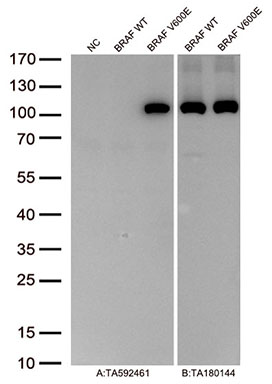 Figure A, Western blot analysis of overexpressed lysates(25ug per lane)  from  HEK293T cells transfected with empty plasmid (<a href = "https://www.origene.com/catalog/vectors/mammalian-expression-vectors/ps100001-pcmv6-entry-mammalian-expression-vector" title="PS100001" class="">PS100001</a>, NC) , human BRAF wild type plasmid (<a href = "https://www.origene.com/catalog/cdna-clones/expression-plasmids/rc211013-b-raf-braf-nm-004333-human-tagged-orf-clone" title="RC211013" class="">RC211013</a>, lane BRAF WT), human RAF V600E mutant plasmid (<a href = "https://www.origene.com/catalog/cdna-clones/mutant-orf-clones/rc400155-b-raf-braf-nm-004333-human-mutant-orf-clone" title="RC400155" class="">RC400155</a>, lane BRAF V600E) using anti-BRAF V600E antibody TA592461 (1:3000@1mg/ml). Figure B, Western blot analysis of the same human BRAF wild type and  human RAF V600E mutant samples as figure A with anti-DDK antibody (<a href = "https://www.origene.com/catalog/antibodies/tag-antibodies/ta180144-ddk-flag-mouse-monoclonal-antibody-clone-oti11c3" title="TA180144" class="">TA180144</a>, 1:10000@1mg/ml)