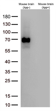 Western blot analysis of extracts (30ug per lane) from Mouse brain(without phosphatase treatment, λpp-) and Mouse brain(with phosphatase treatment, λpp+) lysates by using anti-P-tau217 antibody (TA592992,1:5000@1mg/ml).