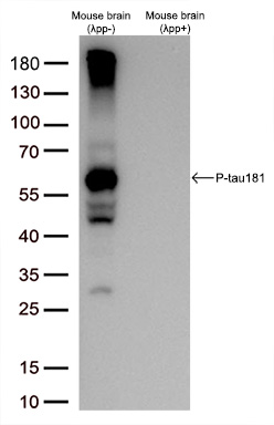 Western blot analysis of extracts (30ug per lane) from Mouse brain(without phosphatase treatment, λpp-) and Mouse brain(with phosphatase treatment, λpp+) lysates by using anti-P-tau181 antibody (TA594033,1:5000@1mg/ml).