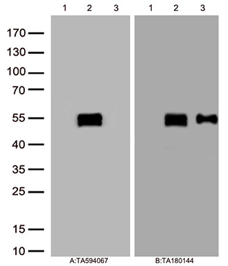 CD37 Rabbit Monoclonal Antibody [Clone ID: OTIR5B5]