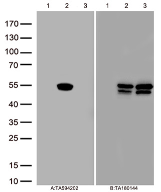 Aurora A (AURKA) Rabbit Monoclonal Antibody [Clone ID: OTIR1C2]