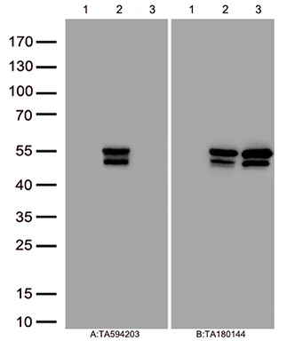 Aurora A (AURKA) Rabbit Monoclonal Antibody [Clone ID: OTIR1H2]