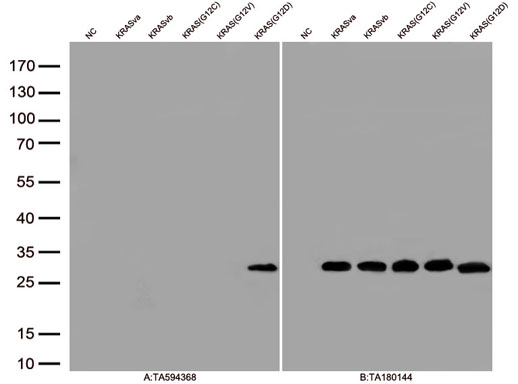 Figure A, Western blot analysis of overexpressed lysates(15ug per lane)  from  HEK293T cells transfected with empty plasmid (<a href = "https://www.origene.com/catalog/vectors/mammalian-expression-vectors/ps100001-pcmv6-entry-mammalian-expression-vector" title="PS100001" class="">PS100001</a>, NC) , human KRASva plasmid (<a href = "https://www.origene.com/catalog/cdna-clones/expression-plasmids/rc222697-kras-nm-033360-human-tagged-orf-clone" title="RC222697" class="">RC222697</a>, KRASva), human KRASvb plasmid (<a href = "https://www.origene.com/catalog/cdna-clones/expression-plasmids/rc201958-kras-nm-004985-human-tagged-orf-clone" title="RC201958" class="">RC201958</a>, KRASvb),  KRAS(G12C) plasmid (<a href = "https://www.origene.com/catalog/cdna-clones/mutant-orf-clones/rc400107-kras-nm-004985-human-mutant-orf-clone" title="RC400107" class="">RC400107</a>, KRAS(G12C)), KRAS(G12V) plasmid (<a href = "https://www.origene.com/catalog/cdna-clones/mutant-orf-clones/rc400109-kras-nm-004985-human-mutant-orf-clone" title="RC400109" class="">RC400109</a>, KRAS(G12V)), KRAS(G12D) plasmid (<a href = "https://www.origene.com/catalog/cdna-clones/mutant-orf-clones/rc400104-kras-nm-004985-human-mutant-orf-clone" title="RC400104" class="">RC400104</a>, KRAS(G12D))using anti-KRAS mutant (G12D) antibody TA594368(1:100). Figure B, Western blot analysis of  the same samples as figure A with anti-DDK antibody (<a href = "https://www.origene.com/catalog/antibodies/tag-antibodies/ta180144-ddk-flag-mouse-monoclonal-antibody-clone-oti11c3" title="TA180144" class="">TA180144</a>, 1:1000)