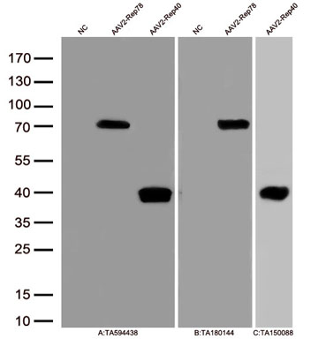 Figure A, Western blot analysis of overexpressed lysates(15ug per lane)  from  HEK293T cells transfected with empty plasmid (<a href = "https://www.origene.com/catalog/vectors/mammalian-expression-vectors/ps100001-pcmv6-entry-mammalian-expression-vector" title="PS100001" class="">PS100001</a>, NC) ,  AAV2-Rep78 overexpressed plasmid and AAV2-Rep40 protein (0.1ug) using anti-AAV2(Rep78, 68, 52, 40)  antibody TA594438 (1:2000). Figure B, Western blot analysis of  the same samples as figure A with anti-DDK antibody (<a href = "https://www.origene.com/catalog/antibodies/tag-antibodies/ta180144-ddk-flag-mouse-monoclonal-antibody-clone-oti11c3" title="TA180144" class="">TA180144</a>, 1:1000). Figure C, Western blot analysis of  the same samples as figure A with anti-His antibody (<a href = "https://www.origene.com/catalog/antibodies/tag-antibodies/ta150088-clone-oti2b5-anti-his-mouse-monoclonal-antibody" title="TA150088" class="">TA150088</a>, 1:500).