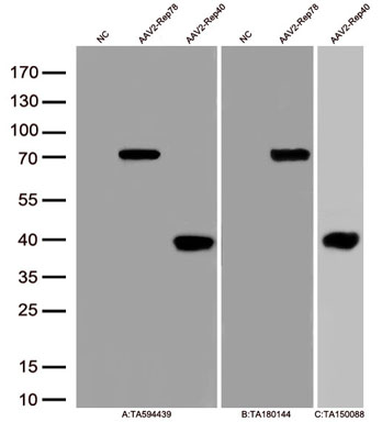 Figure A, Western blot analysis of overexpressed lysates(15ug per lane)  from  HEK293T cells transfected with empty plasmid (<a href = "https://www.origene.com/catalog/vectors/mammalian-expression-vectors/ps100001-pcmv6-entry-mammalian-expression-vector" title="PS100001" class="">PS100001</a>, NC) ,  AAV2-Rep78 overexpressed plasmid and AAV2-Rep40 protein (0.1ug) using anti-AAV2(Rep78, 68, 52, 40)  antibody TA594439 (1:2000). Figure B, Western blot analysis of  the same samples as figure A with anti-DDK antibody (<a href = "https://www.origene.com/catalog/antibodies/tag-antibodies/ta180144-ddk-flag-mouse-monoclonal-antibody-clone-oti11c3" title="TA180144" class="">TA180144</a>, 1:1000). Figure C, Western blot analysis of  the same samples as figure A with anti-His antibody (<a href = "https://www.origene.com/catalog/antibodies/tag-antibodies/ta150088-clone-oti2b5-anti-his-mouse-monoclonal-antibody" title="TA150088" class="">TA150088</a>, 1:500).
