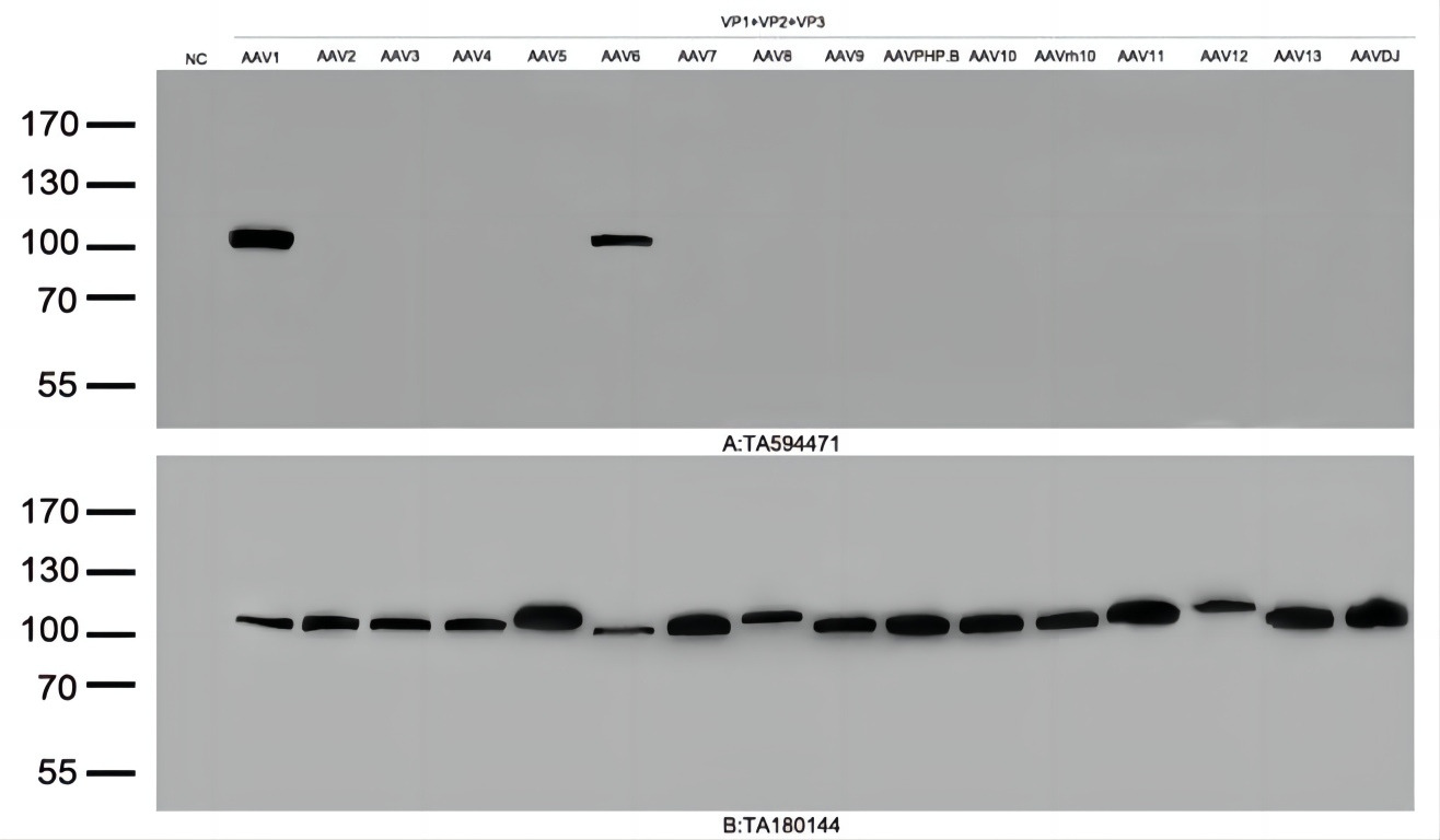 Figure A, Western blot analysis of overexpressed lysates(25ug per lane)  from  HEK293T cells transfected with empty plasmid (<a href = "https://www.origene.com/catalog/vectors/mammalian-expression-vectors/ps100001-pcmv6-entry-mammalian-expression-vector" title="PS100001" class="">PS100001</a>, NC) and 16 different AAV capsid proteins using anti-AAV1 antibody TA594471(1:2000). Figure B, Western blot analysis of  the same samples as figure A with anti-DDK antibody (<a href = "https://www.origene.com/catalog/antibodies/tag-antibodies/ta180144-ddk-flag-mouse-monoclonal-antibody-clone-oti11c3" title="TA180144" class="">TA180144</a>, 1:1000).From  the results,TA594471 recognize AAV1 and AAV6 capsid proteins.