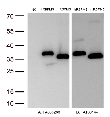 RBPMS Mouse Monoclonal Antibody [Clone ID: OTI3B7]