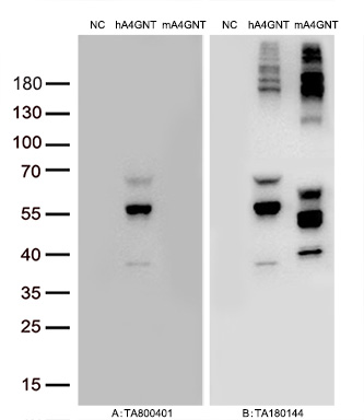 Figure A, Western blot analysis of overexpressed lysates (15ug per lane) from HEK293T cells transfected with empty plasmid (<a href = "https://www.origene.com/catalog/vectors/mammalian-expression-vectors/ps100001-pcmv6-entry-mammalian-expression-vector" title="PS100001" class="">PS100001</a>, NC), human A4GNT  plasmid (<a href = "https://www.origene.com/catalog/cdna-clones/expression-plasmids/rc221256-a4gnt-nm-016161-human-tagged-orf-clone" title="RC221256" class="">RC221256</a>, hA4GNT), mouse A4GNT plasmid (<a href = "https://www.origene.com/catalog/cdna-clones/expression-plasmids/mr215139-a4gnt-nm-001077424-mouse-tagged-orf-clone" title="MR215139" class="">MR215139</a>, mA4GNT) using anti-A4GNT antibody <a href = "https://www.origene.com/catalog/antibodies/primary-antibodies/ta800401-a4gnt-mouse-monoclonal-antibody-clone-id-oti1f7" title="TA800401" class="">TA800401</a> (1:10000@1mg/ml). Figure B, Western blot analysis of  the same samples as figure A with anti-DDK antibody (<a href = "https://www.origene.com/catalog/antibodies/tag-antibodies/ta180144-ddk-flag-mouse-monoclonal-antibody-clone-oti11c3" title="TA180144" class="">TA180144</a>, 1:10000@1mg/ml)