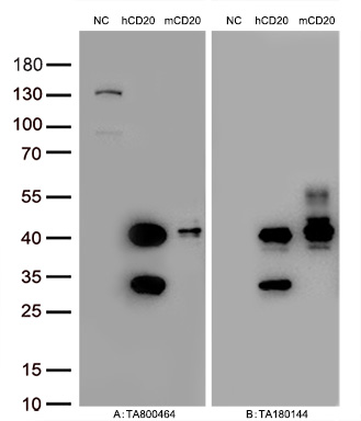 Figure A, Western blot analysis of overexpressed lysates (15ug per lane) from HEK293T cells transfected with empty plasmid (<a href = "https://www.origene.com/catalog/vectors/mammalian-expression-vectors/ps100001-pcmv6-entry-mammalian-expression-vector" title="PS100001" class="">PS100001</a>, NC), human CD20  plasmid (<a href = "https://www.origene.com/catalog/cdna-clones/expression-plasmids/rc201242-cd20-ms4a1-nm-021950-human-tagged-orf-clone" title="RC201242" class="">RC201242</a>, hCD20), mouse CD20 plasmid (<a href = "https://www.origene.com/catalog/cdna-clones/expression-plasmids/mr203990-ms4a1-nm-007641-mouse-tagged-orf-clone" title="MR203990" class="">MR203990</a>, mCD20) using anti-CD20 antibody TA800464 (1:10000@1mg/ml). Figure B, Western blot analysis of  the same samples as figure A with anti-DDK antibody (<a href = "https://www.origene.com/catalog/antibodies/tag-antibodies/ta180144-ddk-flag-mouse-monoclonal-antibody-clone-oti11c3" title="TA180144" class="">TA180144</a>, 1:10000@1mg/ml).