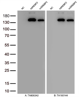 Figure A, Western blot analysis of overexpressed lysates (15ug per lane) from HEK293T cells transfected with empty plasmid (<a href = "https://www.origene.com/catalog/vectors/mammalian-expression-vectors/ps100001-pcmv6-entry-mammalian-expression-vector" title="PS100001" class="">PS100001</a>, NC), human SREBP2  plasmid (<a href = "https://www.origene.com/catalog/cdna-clones/expression-plasmids/rc208942-srebp2-srebf2-nm-004599-human-tagged-orf-clone" title="RC208942" class="">RC208942</a>, hSREBP2), mouse SREBP2 plasmid (<a href = "https://www.origene.com/catalog/cdna-clones/expression-plasmids/mr226021-srebf2-nm-033218-mouse-tagged-orf-clone" title="MR226021" class="">MR226021</a>, mSREBP2) using anti-SREBP2 antibody TA806342 (1:10000@1mg/ml ). Figure B, Western blot analysis of  the same samples as figure A with anti-DDK antibody (<a href = "https://www.origene.com/catalog/antibodies/tag-antibodies/ta180144-ddk-flag-mouse-monoclonal-antibody-clone-oti11c3" title="TA180144" class="">TA180144</a>, 1:10000@1mg/ml)