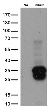 HEK293T cells were transfected with the pCMV6-ENTRY control (Cat# <a href = "https://www.origene.com/catalog/vectors/mammalian-expression-vectors/ps100001-pcmv6-entry-mammalian-expression-vector" title="PS100001" class="">PS100001</a>, Left lane) or pCMV6-ENTRY BCL2 (Cat# <a href = "https://www.origene.com/catalog/cdna-clones/expression-plasmids/rc204498-bcl2-nm-000633-human-tagged-orf-clone" title="RC204498" class="">RC204498</a>, Right lane) cDNA for 48 hrs and lysed. Equivalent amounts of cell lysates (5 ug per lane) were separated by SDS-PAGE and immunoblotted with anti-BCL2 (Cat# <a href = "https://www.origene.com/catalog/antibodies/primary-antibodies/ta806591-bcl2-mouse-monoclonal-antibody-clone-id-oti9d3" title="TA806591" class="">TA806591</a>). Positive lysates <a href = "https://www.origene.com/catalog/proteins/over-expression-lysates/ly424602-bcl2-nm-000633-human-over-expression-lysate" title="LY424602" class="">LY424602</a> (100ug) and <a href = "https://www.origene.com/catalog/proteins/over-expression-lysates/lc424602-bcl2-nm-000633-human-over-expression-lysate" title="LC424602" class="">LC424602</a> (20ug) can be purchased separately from OriGene.