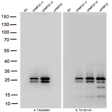 PMP22 Mouse Monoclonal Antibody [Clone ID: OTI5D1]