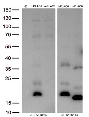 Figure A, Western blot analysis of overexpressed lysates (15ug per lane) from HEK293T cells transfected with empty plasmid (<a href = "https://www.origene.com/catalog/vectors/mammalian-expression-vectors/ps100001-pcmv6-entry-mammalian-expression-vector" title="PS100001" class="">PS100001</a>, NC), human PLAC8 plasmid (<a href = "https://www.origene.com/catalog/cdna-clones/expression-plasmids/rc212588-plac8-nm-016619-human-tagged-orf-clone" title="RC212588" class="">RC212588</a>, hPLAC8), mouse PLAC8 plasmid (<a href = "https://www.origene.com/catalog/cdna-clones/expression-plasmids/mr200440-plac8-nm-139198-mouse-tagged-orf-clone" title="MR200440" class="">MR200440</a>, mPLAC8) using anti-PLAC8 antibody <a href = "https://www.origene.com/catalog/antibodies/primary-antibodies/ta810807-plac8-mouse-monoclonal-antibody-clone-id-oti2e10" title="TA810807" class="">TA810807</a> (1:10000@1mg/ml). Figure B, Western blot analysis of the same human PLAC8 and mouse PLAC8 samples as figure A with anti-DDK antibody (<a href = "https://www.origene.com/catalog/antibodies/tag-antibodies/ta180144-ddk-flag-mouse-monoclonal-antibody-clone-oti11c3" title="TA180144" class="">TA180144</a>, 1:10000@1mg/ml)