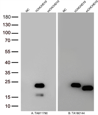 CHCHD10 Mouse Monoclonal Antibody [Clone ID: OTI2B6]