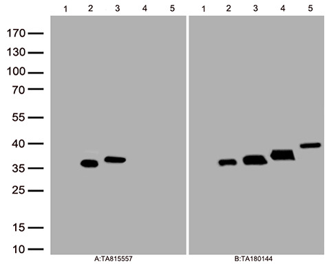 Galectin 3 (LGALS3) Mouse Monoclonal Antibody [Clone ID: OTI12H5]