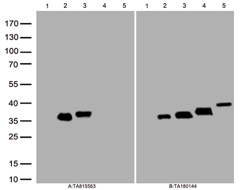 Galectin 3 (LGALS3) Mouse Monoclonal Antibody [Clone ID: OTI9F6]