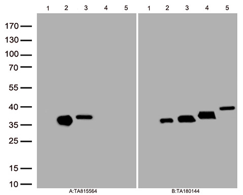 Galectin 3 (LGALS3) Mouse Monoclonal Antibody [Clone ID: OTI3C11]