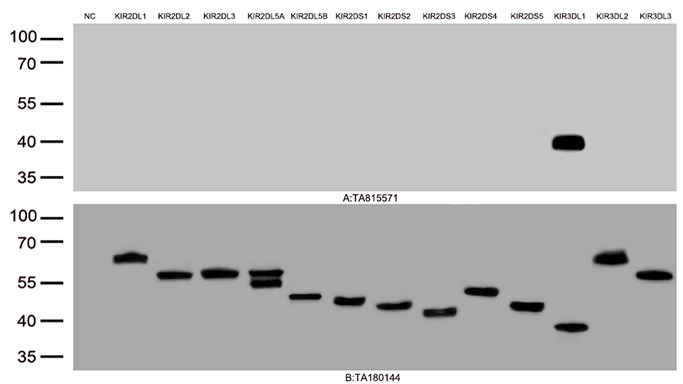 KIR3DL1 Mouse Monoclonal Antibody [Clone ID: OTI1A7]