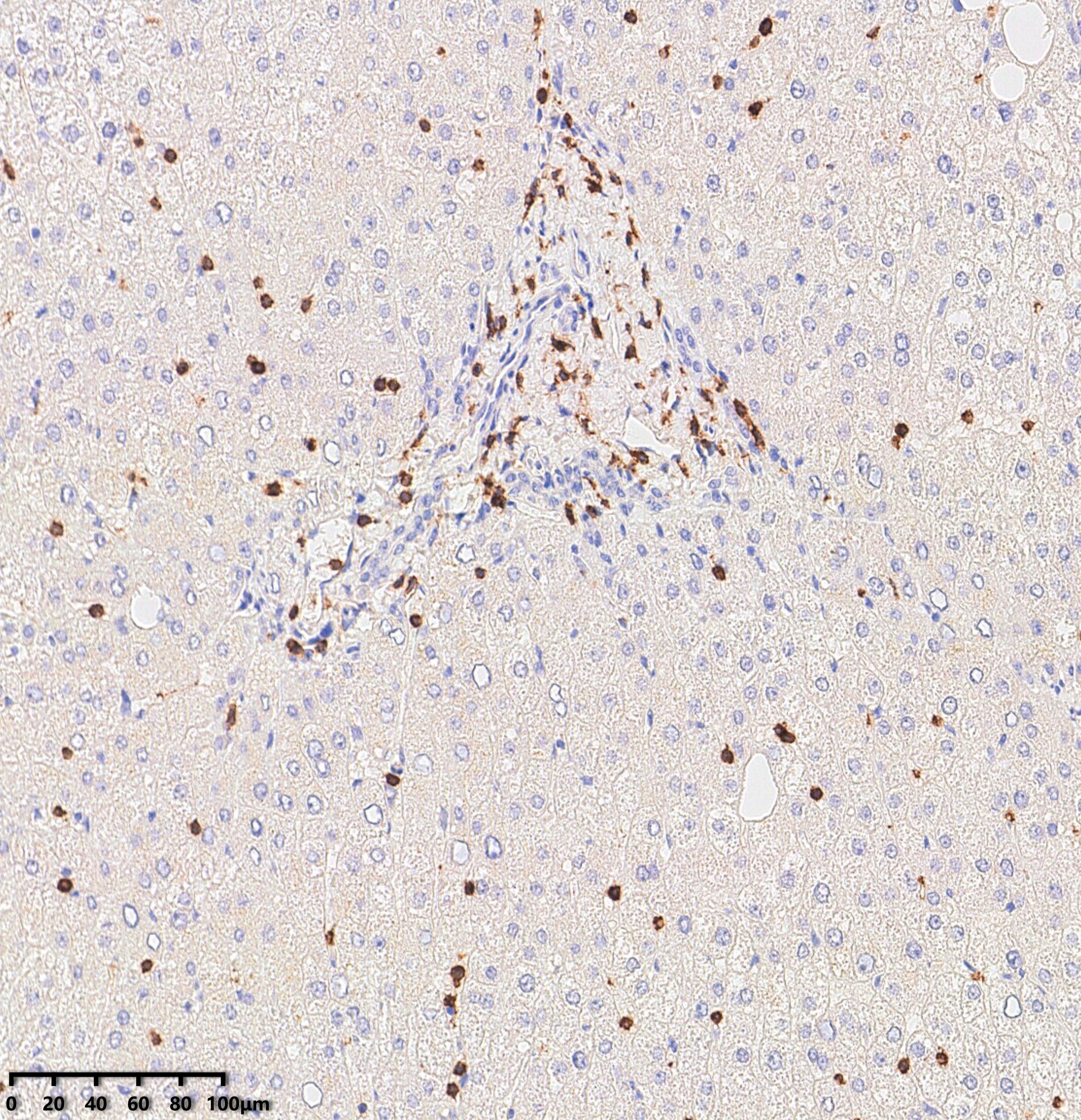 Immunohistochemical staining of paraffin-embedded Liver using anti-CD3E mouse  monoclonal antibody.(Heat-induced epitope retrieval by 1mM EDTA in 10mM Tris buffer (pH9.0) at 120°C for 3 min, <a href = "https://www.origene.com/catalog/antibodies/primary-antibodies/ta815865-cd3e-mouse-monoclonal-antibody-clone-id-oti19b1" title="TA815865" class="">TA815865</a>)