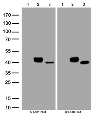 Figure A, Western blot analysis of overexpressed lysates(15ug per lane)  from  HEK293T cells transfected with empty plasmid (<a href='/catalog/vectors/mammalian-expression-vectors/ps100001/pcmv6-entry-mammalian-expression-vector'>PS100001</a>, lane 1) , human HSD11B1 plasmid (<a href='/catalog/cdna-clones/expression-plasmids/rc203109/hsd11b1-nm_005525-human-tagged-orf-clone'>RC203109</a>, lane 2), mouse HSD11B1 plasmid (<a href='/catalog/cdna-clones/expression-plasmids/mr227258/hsd11b1-nm_008288-mouse-tagged-orf-clone'>MR227258</a>, lane 3)using anti-HSD11B1 antibody TA815904 (1:100). Figure B, Western blot analysis of  the same samples as figure A with anti-DDK antibody (<a href='/catalog/antibodies/tag-antibodies/ta180144/ddk-flag-mouse-monoclonal-antibody-clone-oti11c3'>TA180144</a>, 1:1000)