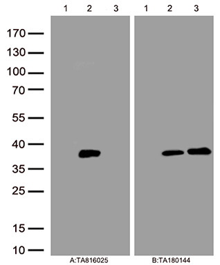 HSD17B11 Mouse Monoclonal Antibody [Clone ID: OTI15D1]