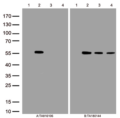 Figure A, Western blot analysis of overexpressed lysates(15ug per lane)  from  HEK293T cells transfected with empty plasmid (<a href = "https://www.origene.com/catalog/vectors/mammalian-expression-vectors/ps100001-pcmv6-entry-mammalian-expression-vector" title="PS100001" class="">PS100001</a>, lane 1) , human HTRA1 plasmid (<a href = "https://www.origene.com/catalog/cdna-clones/expression-plasmids/rc222362-htra1-nm-002775-human-tagged-orf-clone" title="RC222362" class="">RC222362</a>, lane 2), mouse HTRA1 plasmid (<a href = "https://www.origene.com/catalog/cdna-clones/expression-plasmids/mr207695-htra1-nm-019564-mouse-tagged-orf-clone" title="MR207695" class="">MR207695</a>, lane 3), rat HTRA1 plasmid (<a href = "https://www.origene.com/catalog/cdna-clones/expression-plasmids/rr208298-htra1-nm-031721-rat-tagged-orf-clone" title="RR208298" class="">RR208298</a>, lane 4)using anti-HTRA1 antibody TA816106 (1:500). Figure B, Western blot analysis of  the same samples as figure A with anti-DDK antibody (<a href = "https://www.origene.com/catalog/antibodies/tag-antibodies/ta180144-ddk-flag-mouse-monoclonal-antibody-clone-oti11c3" title="TA180144" class="">TA180144</a>, 1:1000)