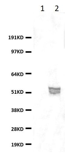 HEK293T cells were transfected with the pCMV6-ENTRY control (lane 1) or pCMV6-ENTRY GSDMD (<a href = "https://www.origene.com/catalog/cdna-clones/expression-plasmids/rc203399-gasdermin-d-gsdmd-nm-024736-human-tagged-orf-clone" title="RC203399" class="">RC203399</a> , lane 2) cDNA for 48 hrs and lysed. Equivalent amounts of cell lysates (5 ug per lane) were separated by SDS-PAGE and immunoblotted with anti-GSDMD (TA899009, 1:500).