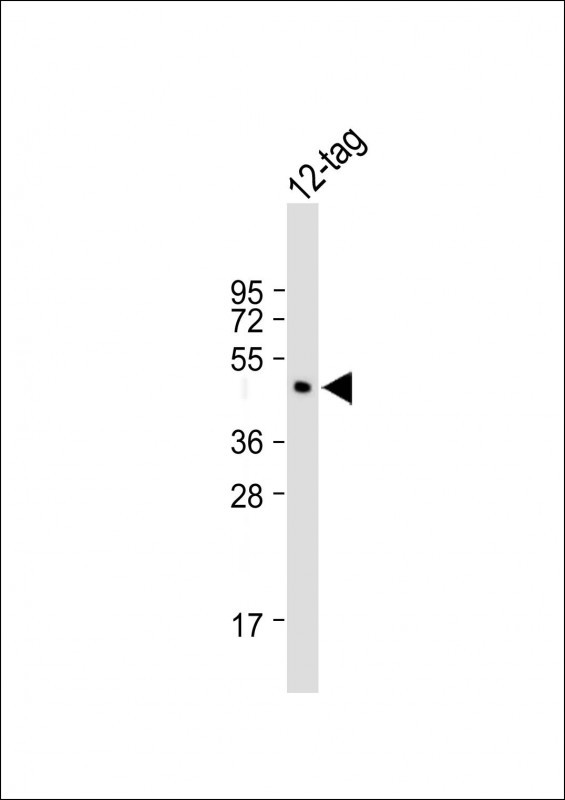 All lanes : Anti-FLAG tag antibody (DYKDDDDK) at 1:2000 dilution
Lane 1: 12-tag recombinant protein  


                                                                                                                                                                                                                                                                                                                                                                                                                                                                                  
Lysates/proteins at 20 µg per lane. 

Secondary
Goat Anti-Rabbit IgG,  (H+L), Peroxidase conjugated at 1/10000 dilution. 

Observed band size : 50 kDa

Blocking/Dilution buffer: 5% NFDM/TBST.