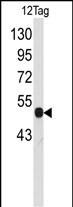 Western blot analysis of anti-Tag-VSV-G Pab (Cat. #AP11022PU-N) in 12tag cell line lysates (35ug/lane). Tag-VSV-G(arrow) was detected using the purified Pab.