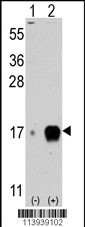 Western blot analysis of IFITM3 (arrow) using rabbit polyclonal IFITM3 Antibody (C-term) (Cat# AP11168PU-N).293 cell lysates (2 ug/lane) either nontransfected (Lane 1) or transiently transfected with the IFITM3 gene (Lane 2) (Origene Technologies).