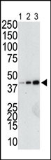 The anti-GST Pab (Cat. #AP11290PU-N) is used in Western blot to detect a GST-fusion recombinant protein (42 kDa) purified from bacterial lysate (Lanes 1-3: 10, 40, and 160 ng GST-fusion protein).