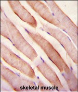 Stanniocalcin-2 (STC2) Antibody (N-term) (Cat. #AP1443a)immunohistochemistry analysis in formalin fixed and paraffin embedded human skeletal muscle followed by peroxidase conjugation of the secondary antibody and DAB staining.This data demonstrates the use of Stanniocalcin-2 (STC2) Antibody (N-term) for immunohistochemistry.  Clinical relevance has not been evaluated.