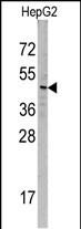 Western blot analysis of SNX6 Antibody (N-term) (Cat# AP11454PU-N) in HepG2 cell line lysates (35ug/lane). SNX6 (arrow) was detected using the purified Pab.