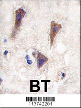 Formalin-fixed and paraffin-embedded human brain tissue reacted with CDH12 antibody (N-term) (Cat.#AP11470PU-N), which was peroxidase-conjugated to the secondary antibody, followed by DAB staining. This data demonstrates the use of this antibody for immunohistochemistry; clinical relevance has not been evaluated.