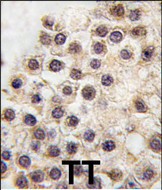 Formalin-fixed and paraffin-embedded human testis tissue reacted with ARIDB3 antibody (C-term) (Cat.#AP11483PU-N), which was peroxidase-conjugated to the secondary antibody, followed by DAB staining. This data demonstrates the use of this antibody for immunohistochemistry; clinical relevance has not been evaluated.