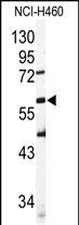 Western blot analysis of SIGLEC6 Antibody (N-term) (Cat.#AP11628PU-N) in  NCI-H460 cell line lysates (35ug/lane). SIGLEC6 (arrow) was detected using the purified Pab.
