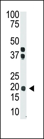 The anti-IL28 Ctr-term Pab (Cat. #AP11656PU-N) is used in Western blot to detect IL28 in mouse brain tissue lysate.