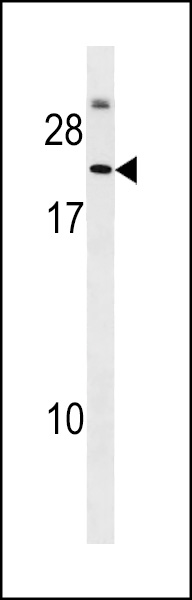 Western blot analysis of anti-T1A-2 Pab (Cat. #AP11877PU-N) in NCI-H460 cell lysate. T1A-2 (Arrow) was detected using purified Pab. Secondary HRP-anti-rabbit was used for signal visualization with chemiluminescence.